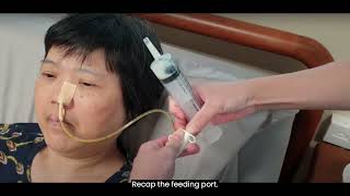 3 Performing Nasogastric Tube NGT Feeding [upl. by Ykcor]