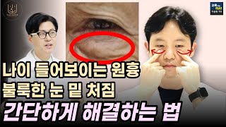 눈 밑 처짐 눈 밑이 불룩해지는 이유 돈 안 들이고 좋아지는 방법 [upl. by Anovahs713]