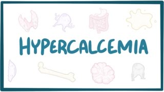 Hypercalcemia  causes symptoms diagnosis treatment pathology [upl. by Bogey]