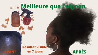 Ne jetez plus vos pelures doignons  5 lotions capillaires et vos cheveux pousseront pour toujours [upl. by Rob]