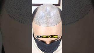 Hair Tattoo for bald head hairtattoo [upl. by Emmerie]