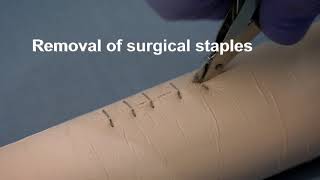 Placing and removing surgical wound closure staples [upl. by Eetnom]