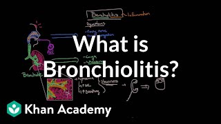 What is bronchiolitis  Respiratory system diseases  NCLEXRN  Khan Academy [upl. by Noryak319]