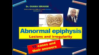 Abnormal epiphysis 15 cases with their answers [upl. by Noryv]