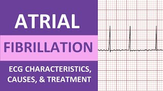 Atrial Fibrillation AFib ECG Treatment Causes Nursing NCLEX Review ACLS [upl. by Durrell]