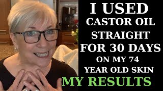 I USED CASTOR OIL FOR 30 DAYS ON MY 74YEAROLD SKIN  MY RESULTS [upl. by Annodal]