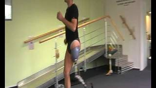 Above knee amputee running on prosthetic leg [upl. by Leverick]