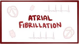 Atrial fibrillation Afib AF  causes symptoms treatment amp pathology [upl. by Srevart]