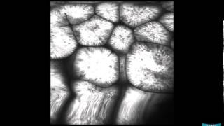 Confocal Endomicroscopy of the Stomach Gastritis Int Metaplasia Adenoma and Gastric Cancer [upl. by Ativak669]