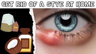 How To Get Rid Of A Stye At Home Natural Remedies For Stye Best Ways To Get Rid Of A Stye Easily [upl. by Hartfield412]