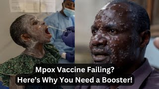 Mpox Vaccine Protection Reduces Why You may Require a Booster Soon [upl. by Giralda877]