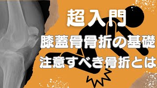 【超入門】膝蓋骨骨折の基礎と注意すべき骨折の種類 [upl. by Regdirb]