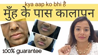 Seborrheic Dermatitis Scalp amp Face l रूसी का बेहतरीन उपाय [upl. by Ashbaugh246]