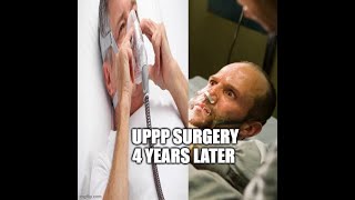 UPPP SURGERY 4 YEARS LATER [upl. by Dranreb165]