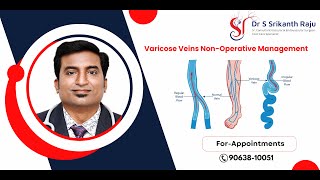 Varicose Veins NonOperative Management  DrSSrikanth Raju  Vascular Surgeon  Hyderabad [upl. by Anirret]