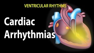 Cardiac Arrhythmias Animation [upl. by Aicemaj]