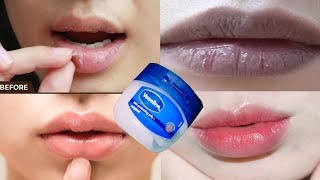 Vaseline petroleum jelly on lips overnight  How to use vaseline for winter dry lips  Vaseline [upl. by Gora]