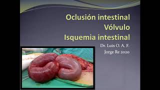 OBSTRUCCION INTESTINAL [upl. by Harlene]