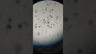 Microcystis Colony under microspore MSc Practical botany practical trendingshorts algae shorts [upl. by Ackerley]