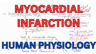 Myocardial Infarction Subendomyocardial Infarction CVS Human Physiology [upl. by Madeleine]