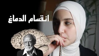 روجر سبيري و نظرية انقسام الدماغ Roger sperry and split brain research [upl. by Himelman]