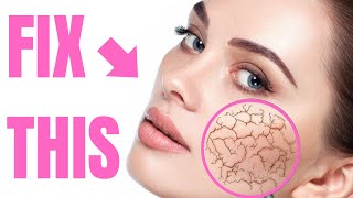 5 Simple Tricks to Get Rid of Dry Skin FOREVER [upl. by Adnarram594]