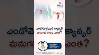 ఎండోమెట్రియల్ క్యాన్సర్ మనుగడ రేటు ఎంత  endometrialcancer shorts trending [upl. by Aseneg793]