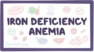 Iron deficiency anemia  an Osmosis Preview [upl. by Wil]