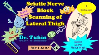 Ultrasound Scanning Principles for Supine Lateral Sacral Plexus or Sciatic Nerve Block DrTuhinM [upl. by Charmian514]