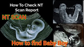 NT SCAN  How to Find Babys Gender In NT SCAN  NT scan report pregnancy ntscanreport ntscan [upl. by Linzy]