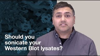 Should you sonicate Western Blot lysates  CST Tech Tips [upl. by Eb427]