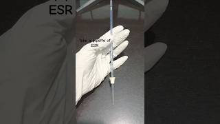 ESR Test Erythrocyte Sedimentation Rate Method  Westergren Manual lab dmlt esr labtechnician [upl. by Deering23]