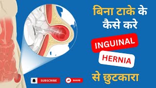 Inguinal Hernia  Signs And Symptoms Explain In Hindi  Dr Ankur Bansal [upl. by Calabrese]