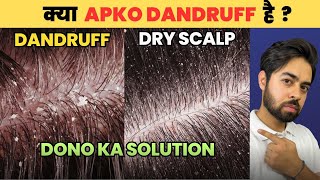 Say Goodbye to Dandruff or Dry Scalp HONEST SOLUTIONS [upl. by Nalyd]