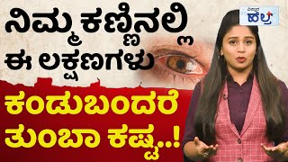 ಎಲ್ಲಾ ಕಡೆ ಈ ಕಾಯಿಲೆ ಬರುತ್ತಿದೆ  Vistara Health  Madras Eye Symptoms And Treatment In Kannada [upl. by Astraea76]