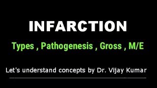 Infarction Pathology  Infarction Types  Infarction Morphology  Pathology Lectures [upl. by Llerrod]