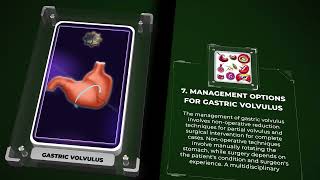 Gastric volvulus [upl. by Michon]