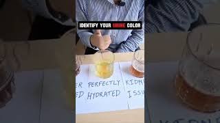 URINE TEST with colour  Use  drink water [upl. by Nodnarbal968]