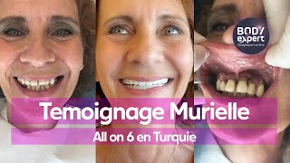 SOINS DENTAIRES  🦷 Témoignage Murielle  All on 6  12 implants  24 couronnes Emax  BODYEXPERT [upl. by Wrightson]