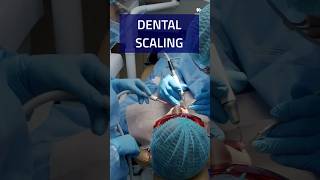 DENTAL SCALING EXPLAINED🧑‍⚕️🦷shorts [upl. by Ynnattirb]