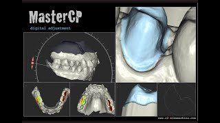 MasterCP Anleitung [upl. by Essile]