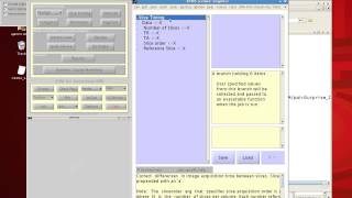 SPM Tutorial 1 Intro to SPM [upl. by Sethi]