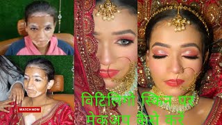 Vitiligo skinHD Bridal makeupvitiligo skin information Cut Crease makeup studio 🫰 [upl. by Etoile604]