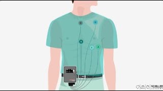 SCHILLER Holter Monitoring [upl. by Green]