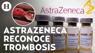 ¿Qué es y cuáles son los síntomas de la trombosis enfermedad ligada a la vacuna de AstraZeneca [upl. by Aurea]