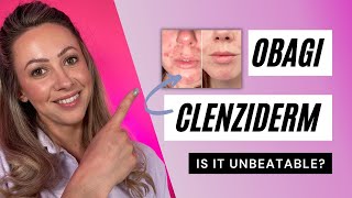 Obagi CLENZIderm MD System  UNBEATABLE ACNE RESULTS [upl. by Naffets]