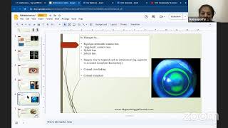 Homeopathy for Keratoconus [upl. by Koch]