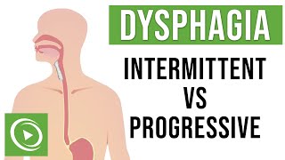 Dysphagia Intermittent vs Progressive Causes Mechanical amp Functional [upl. by Daberath996]