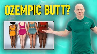 What is Ozempic Butt Dermatologist Explains Everything You Should Know [upl. by Aerdnaek]