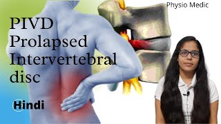 Introduction  Prolapsed Intervertebral DiscPIVD  Made Easy  Hindi  Part 1 Back Pain [upl. by Ramsay]